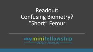 Readout – What to think about when the femur seems too short
