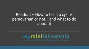 Readout – Is That a Paraovarian Cyst?