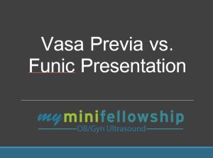 Readout – What’s the difference between vasa previa and funic presentation